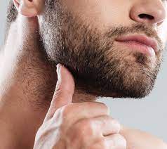 beard transplant