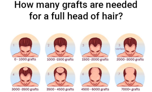 Hair Transplant Grafts