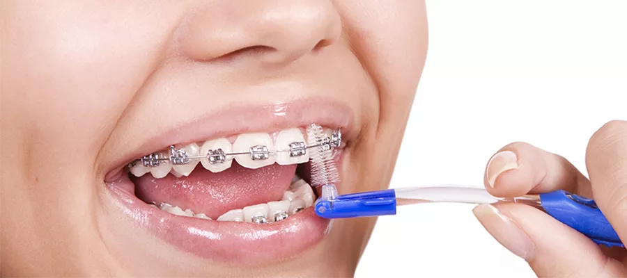 Orthodontic Treatment