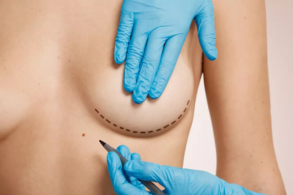 breast-reductionn