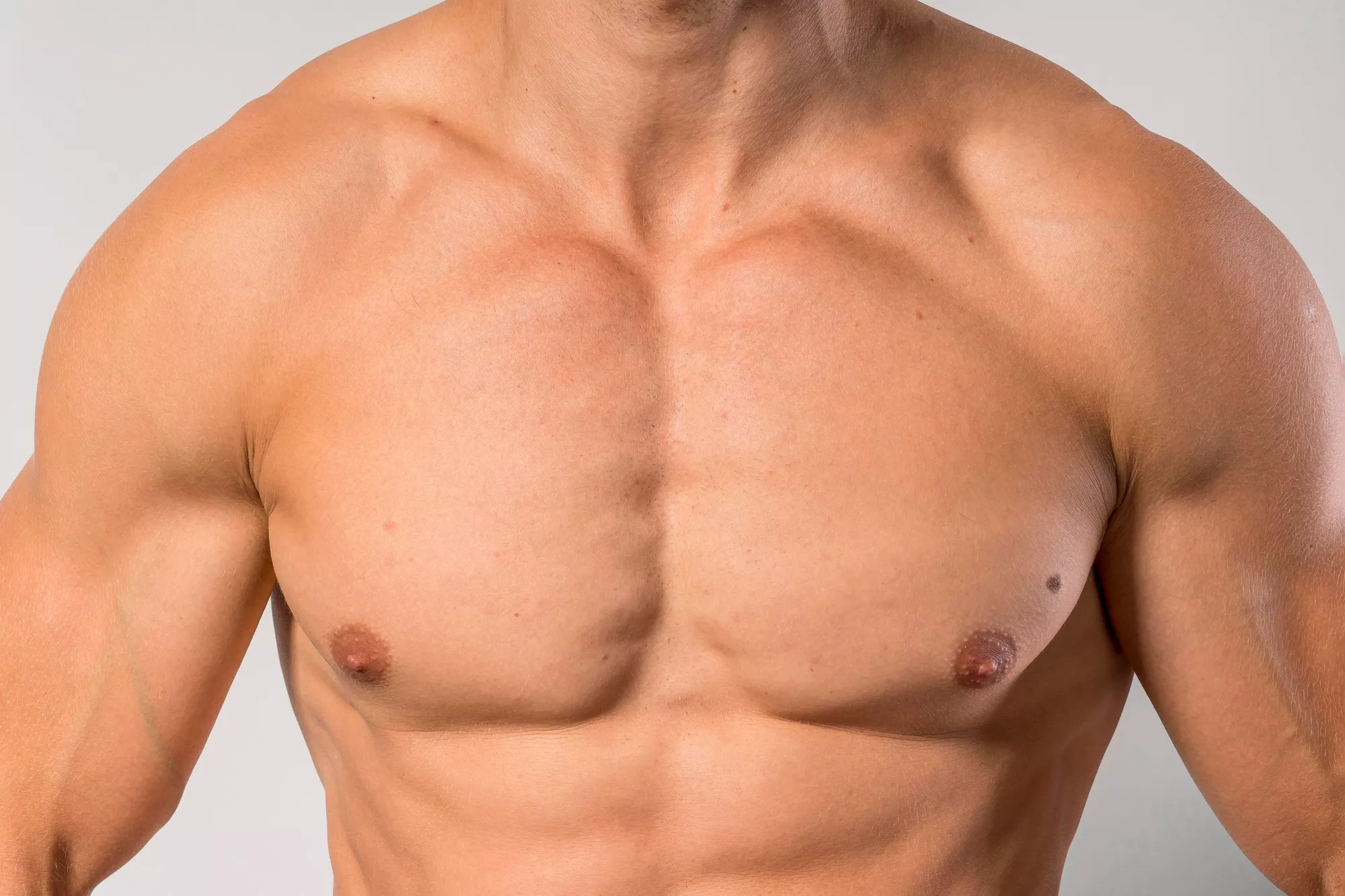 gynecomastia