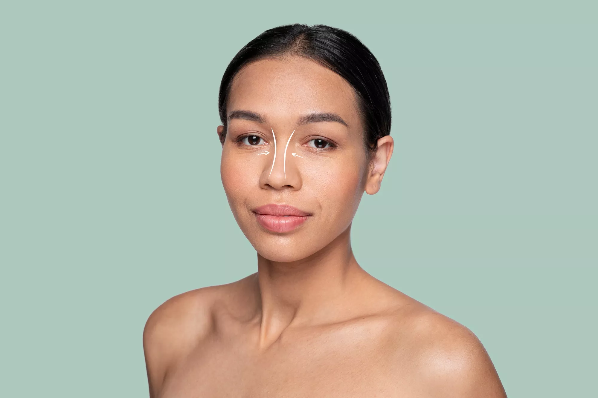 rhinoplasty