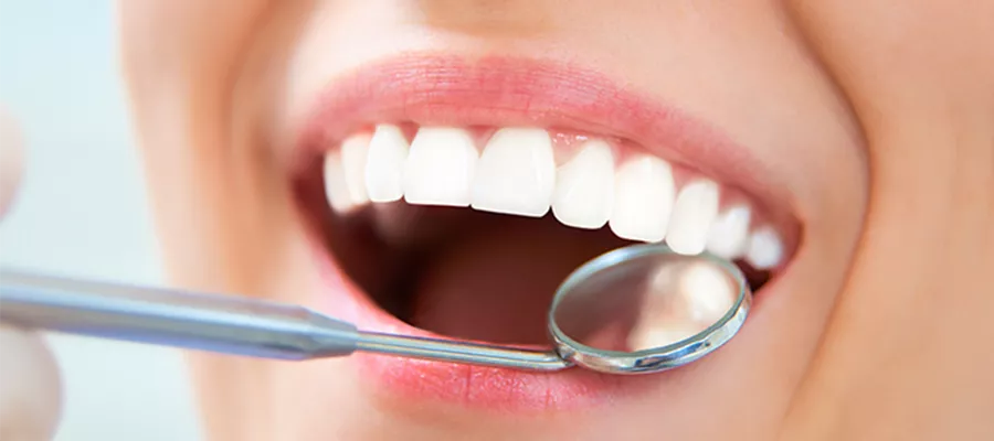 teeth-whitening